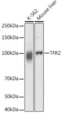 Western Blot: TfR2 Antibody [NBP2-93436] - Western blot analysis of extracts of various cell lines, using TfR2 antibody (NBP2-93436) at 1:1000 dilution. Secondary antibody: HRP Goat Anti-Rabbit IgG (H+L) at 1:10000 dilution. Lysates/proteins: 25ug per lane. Blocking buffer: 3% nonfat dry milk in TBST. Detection: ECL Basic Kit. Exposure time: 10s.